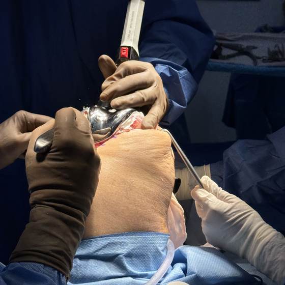Caso real de artroplastia de rodilla 23